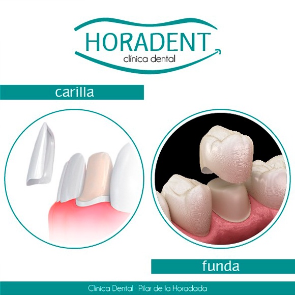 blog-carilla-funda