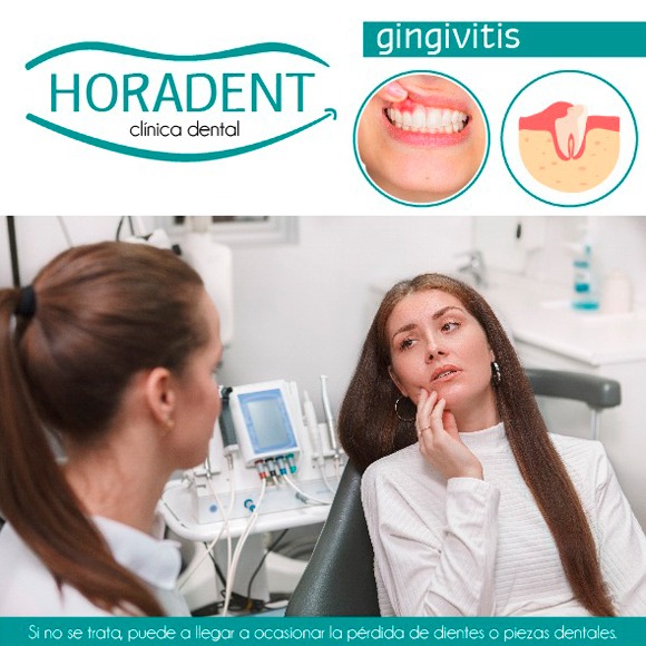 Gingivitis