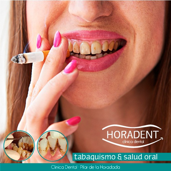 blog-tabaquismo